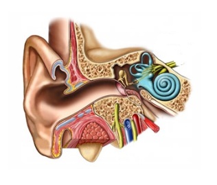 Cochlear_Implant